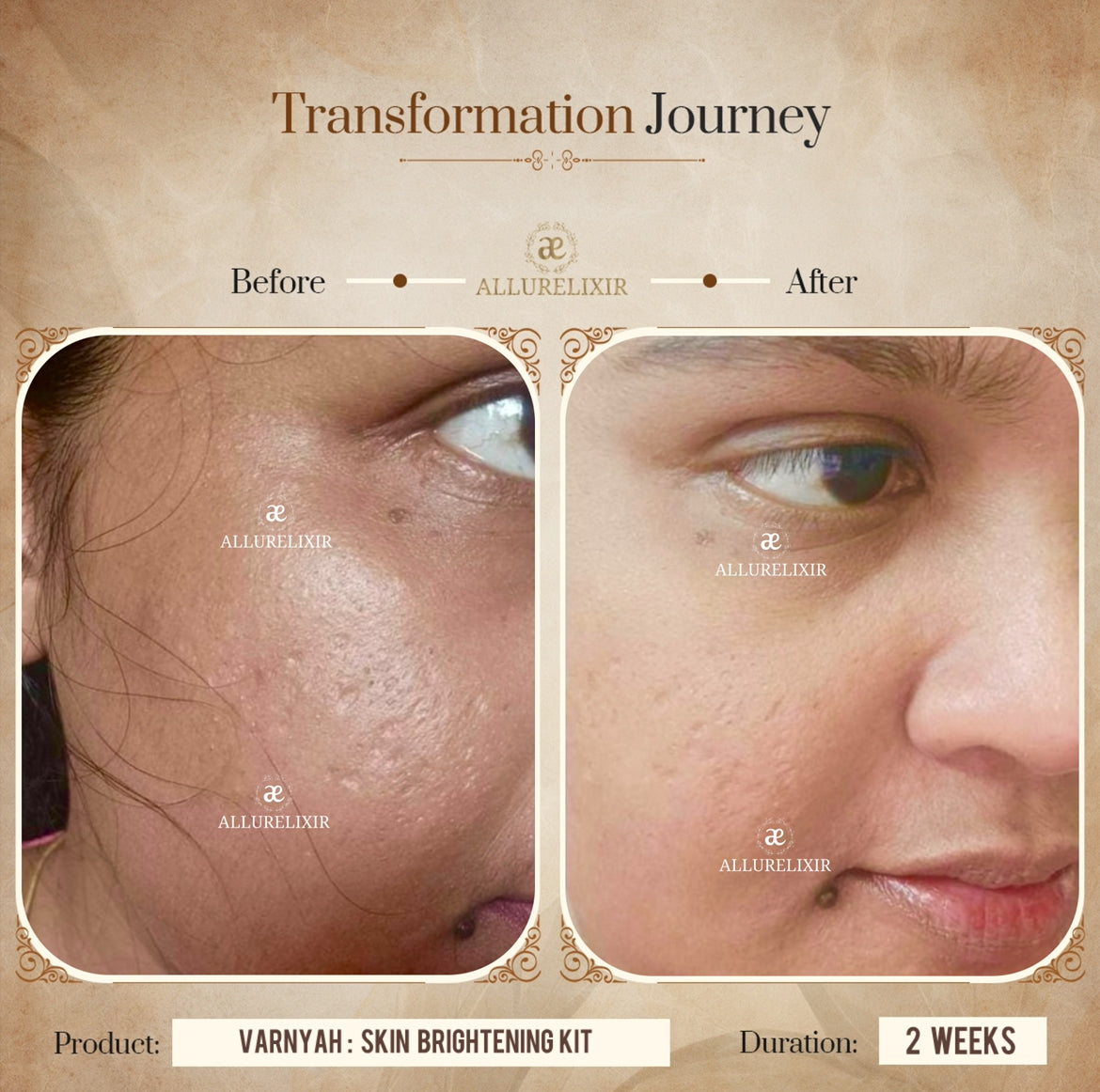 Varnyah : Face Brightening Duo