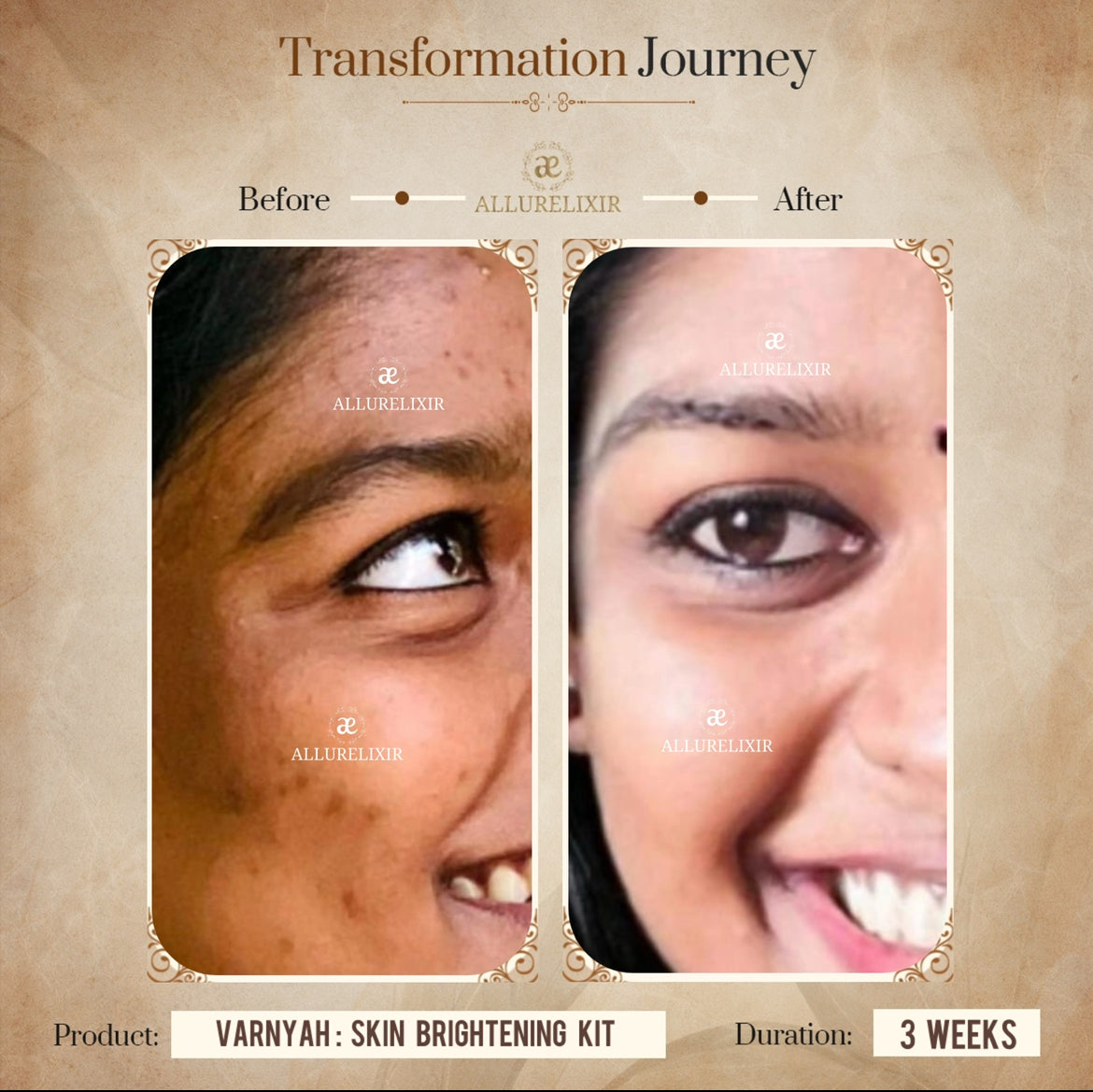 Varnyah : Face Brightening Duo