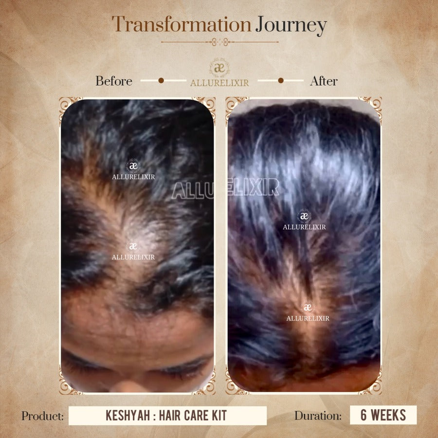 Keshyah: Hair Care Oil (200ml)