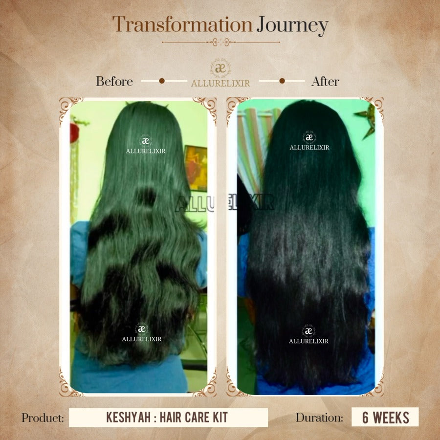 Keshyah: Hair Care Oil (200ml)