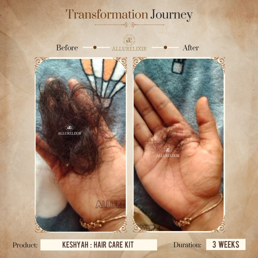 Keshyah: Hair Care Oil (200ml)