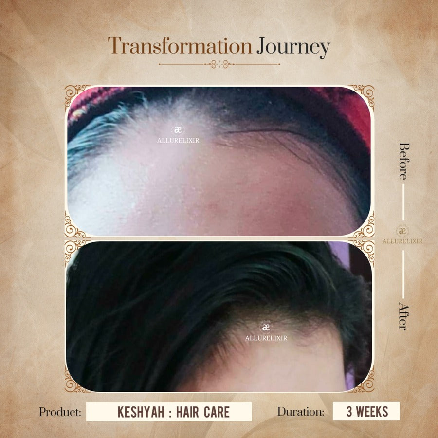 Keshyah: Hair Care Oil (200ml)