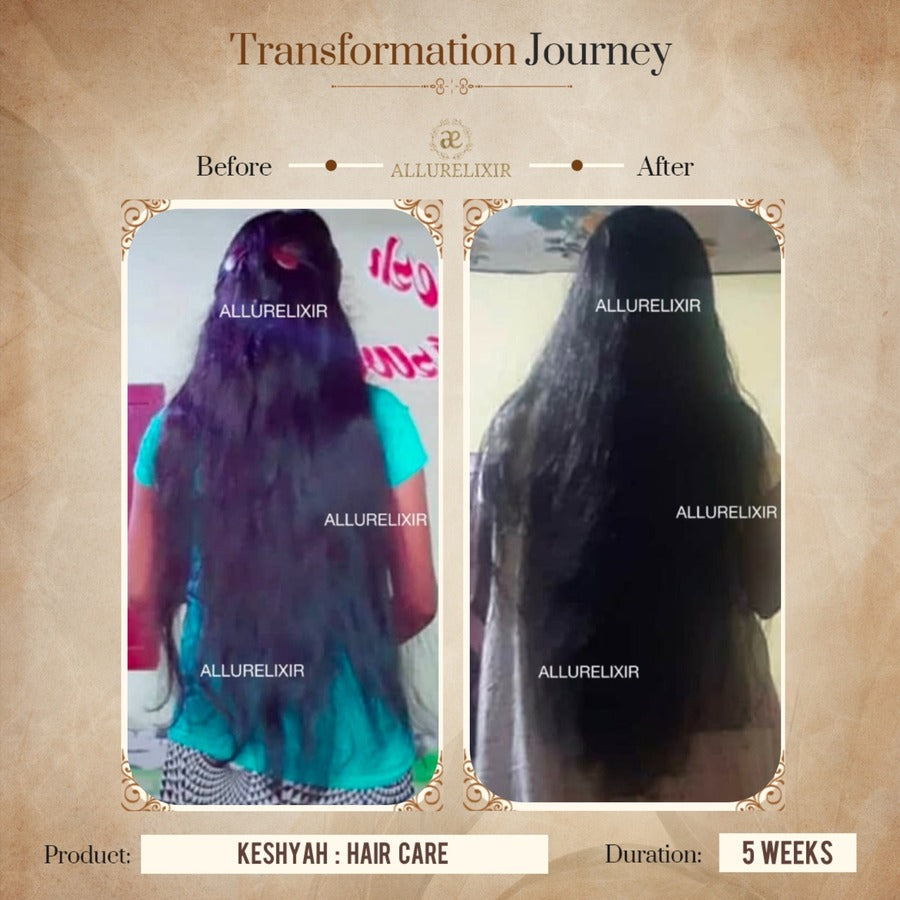 Keshyah: Hair Care Oil (200ml)