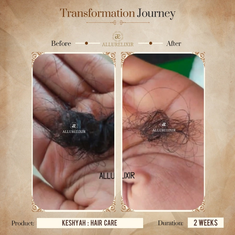 Keshyah: Hair Care Oil (200ml)