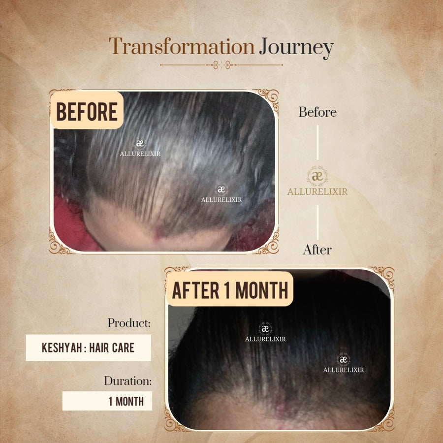 Keshyah: Hair Care Oil (200ml)