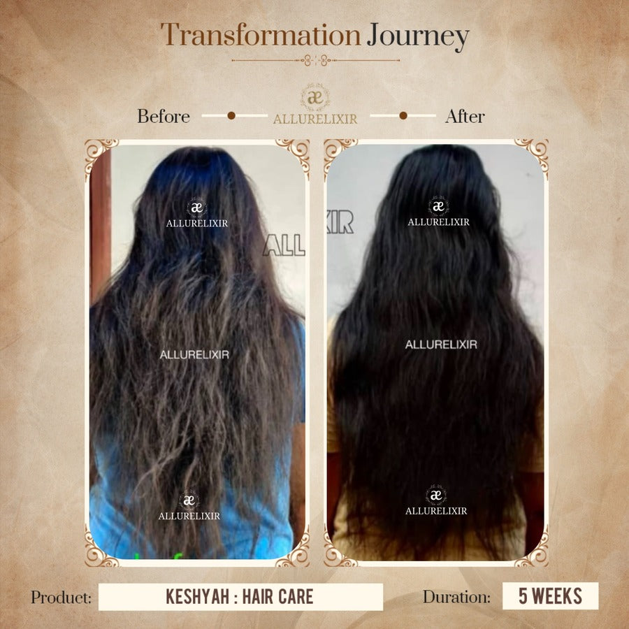 Keshyah: Hair Care Oil (200ml)
