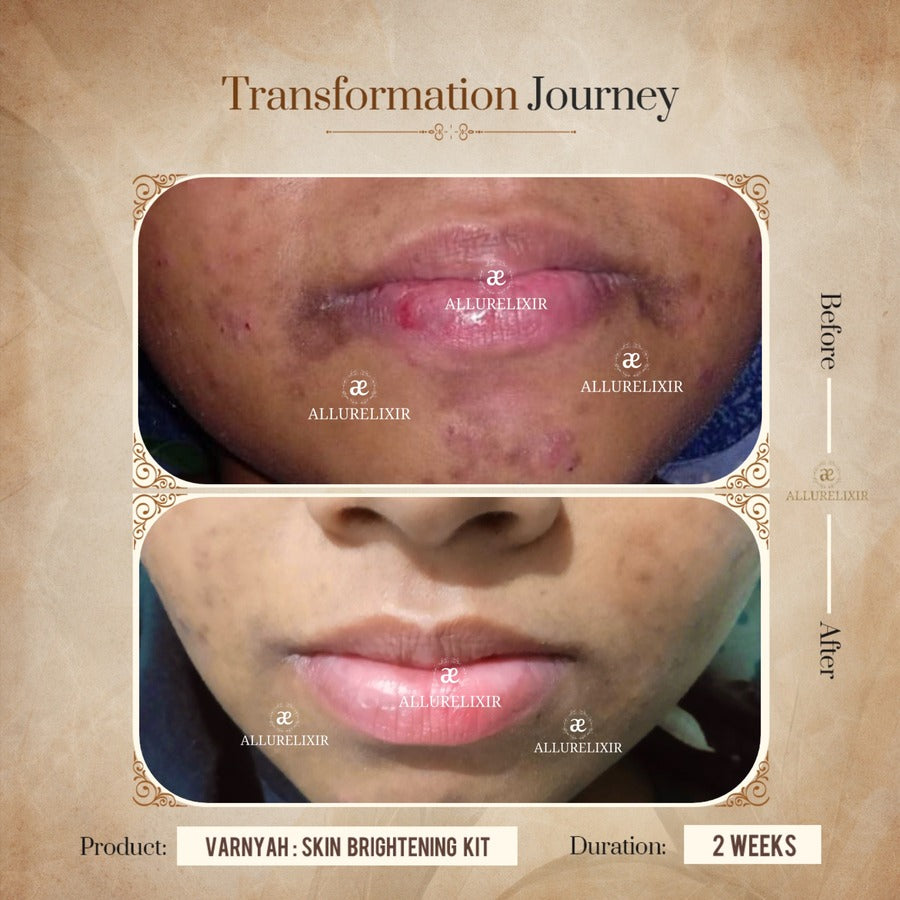 Varnyah : Face Brightening Duo