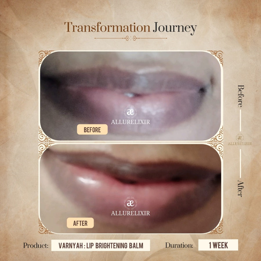 Varnyah: Lip Brightening Balm