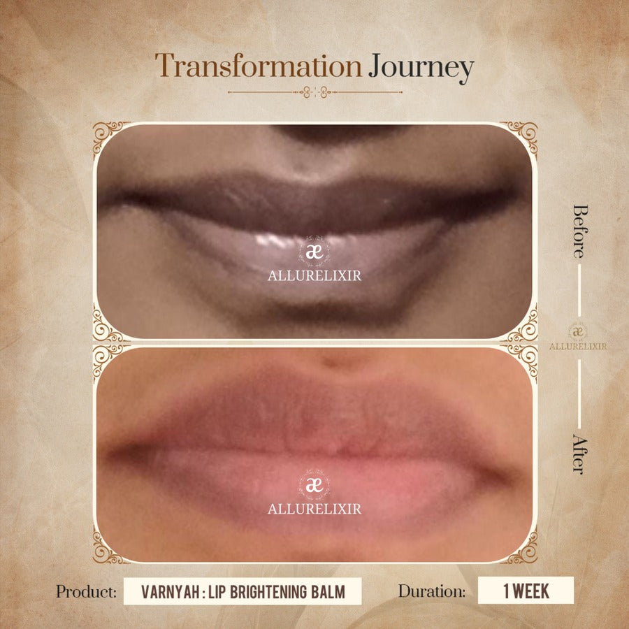 Varnyah: Lip Brightening Balm