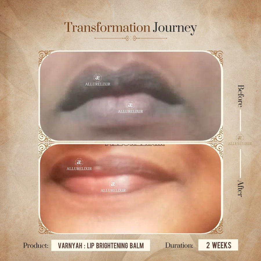 Varnyah: Lip Brightening Balm