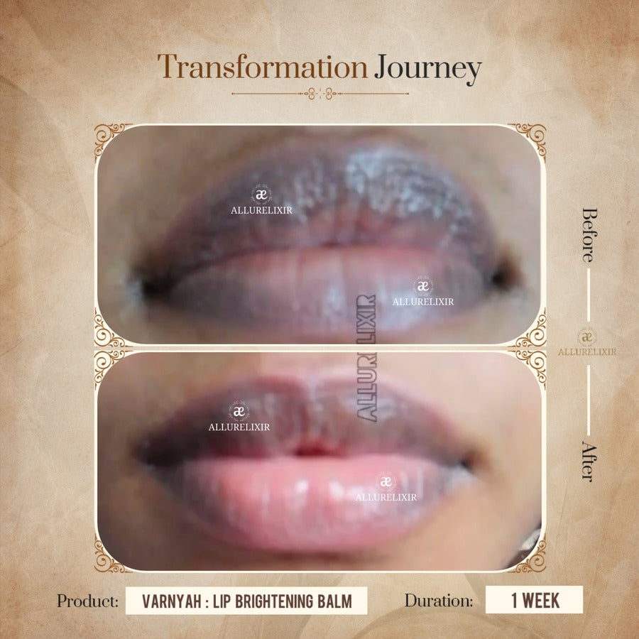Varnyah: Lip Brightening Balm