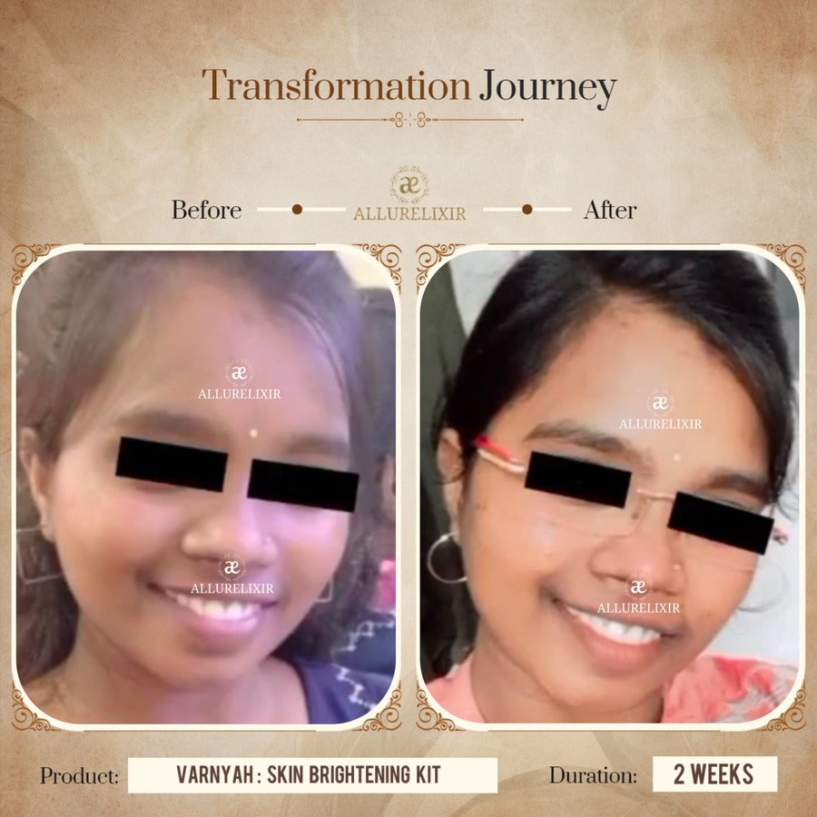 Varnyah : Face Brightening Duo
