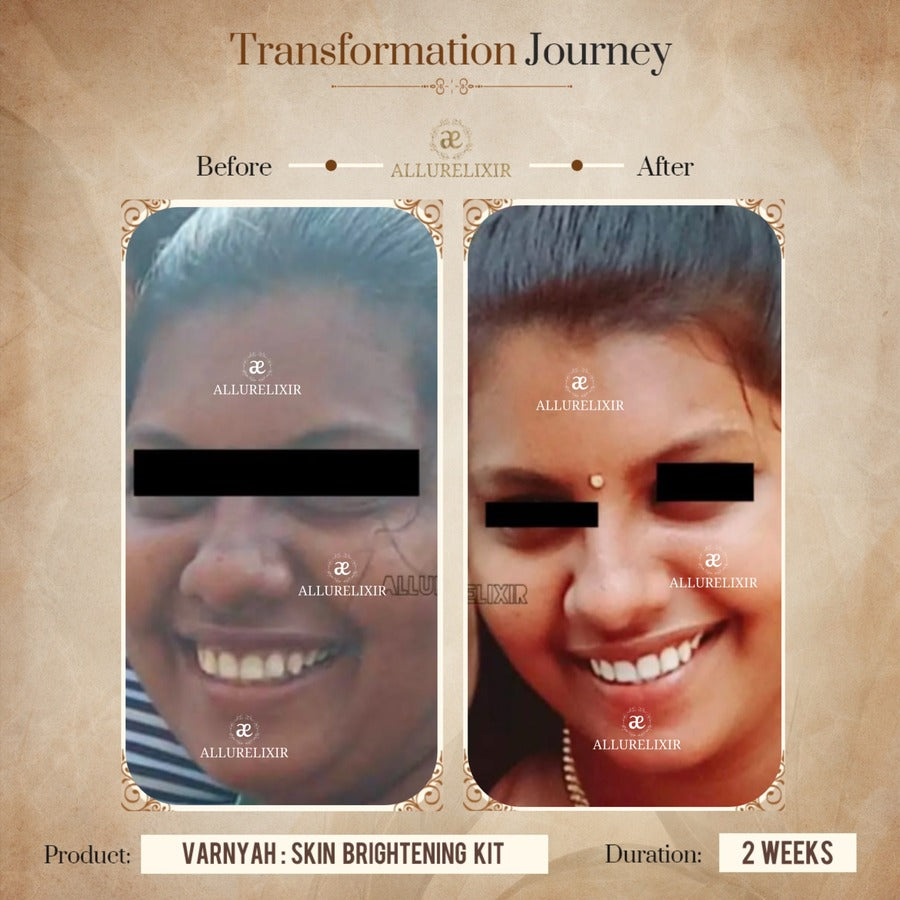 Varnyah : Face Brightening Duo