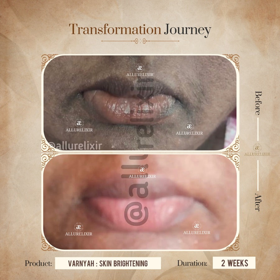 Varnyah: Lip Brightening Balm