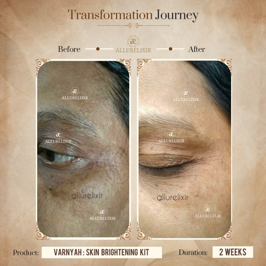 Varnyah : Face Brightening Duo