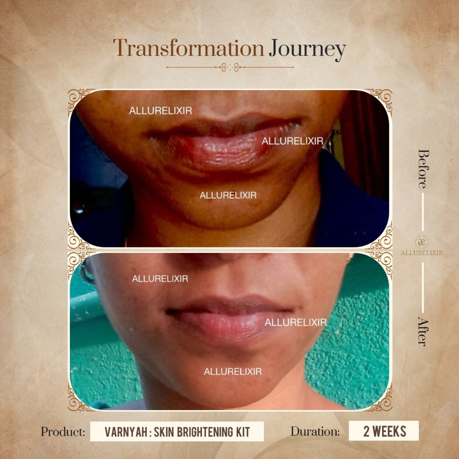 Varnyah : Face Brightening Duo
