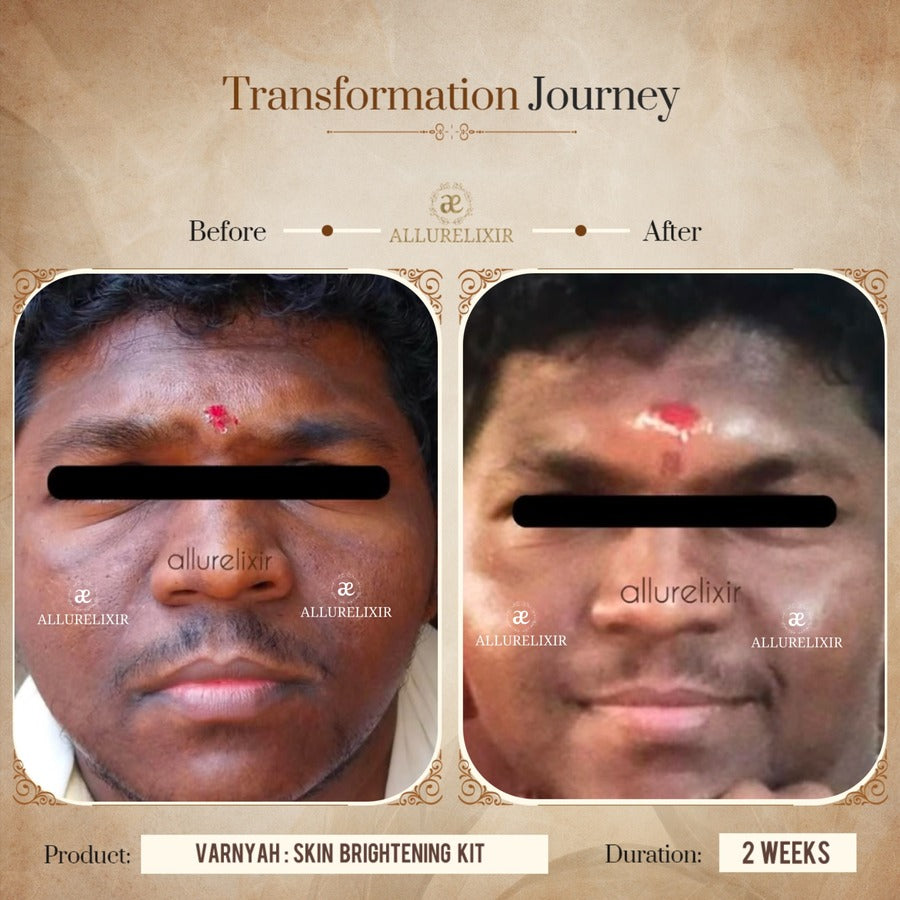 Varnyah : Face Brightening Duo