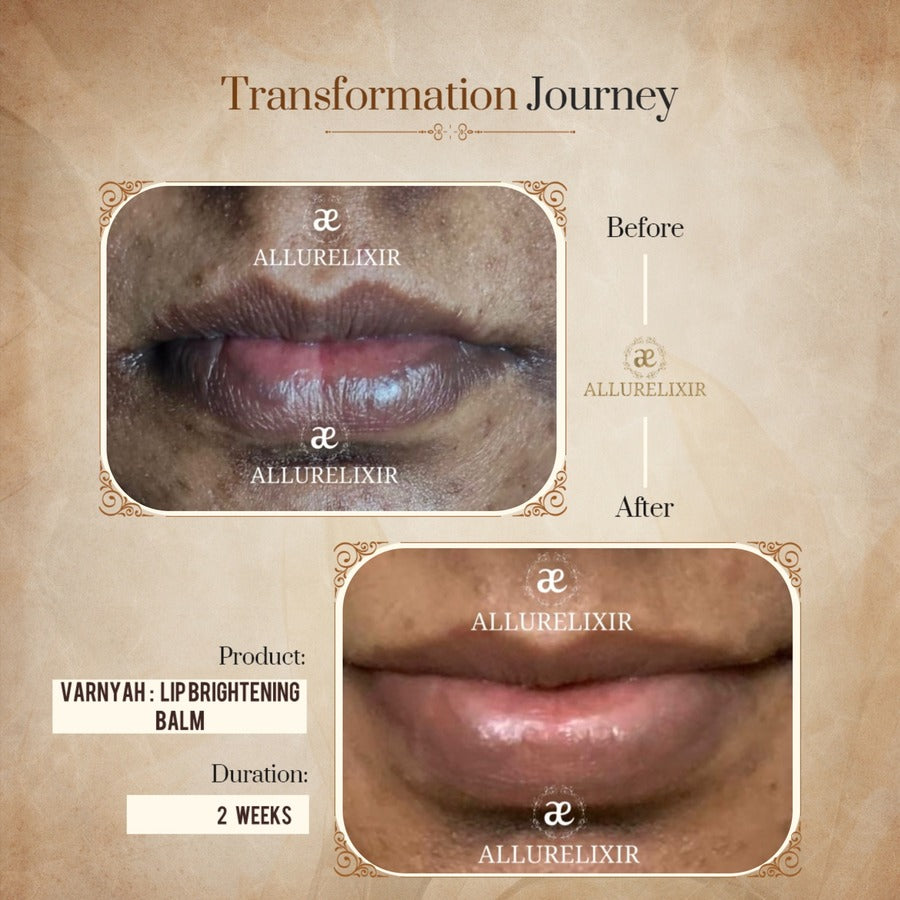 Varnyah: Lip Brightening Balm