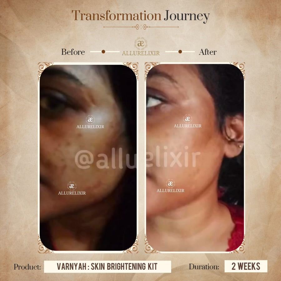 Varnyah : Face Brightening Duo