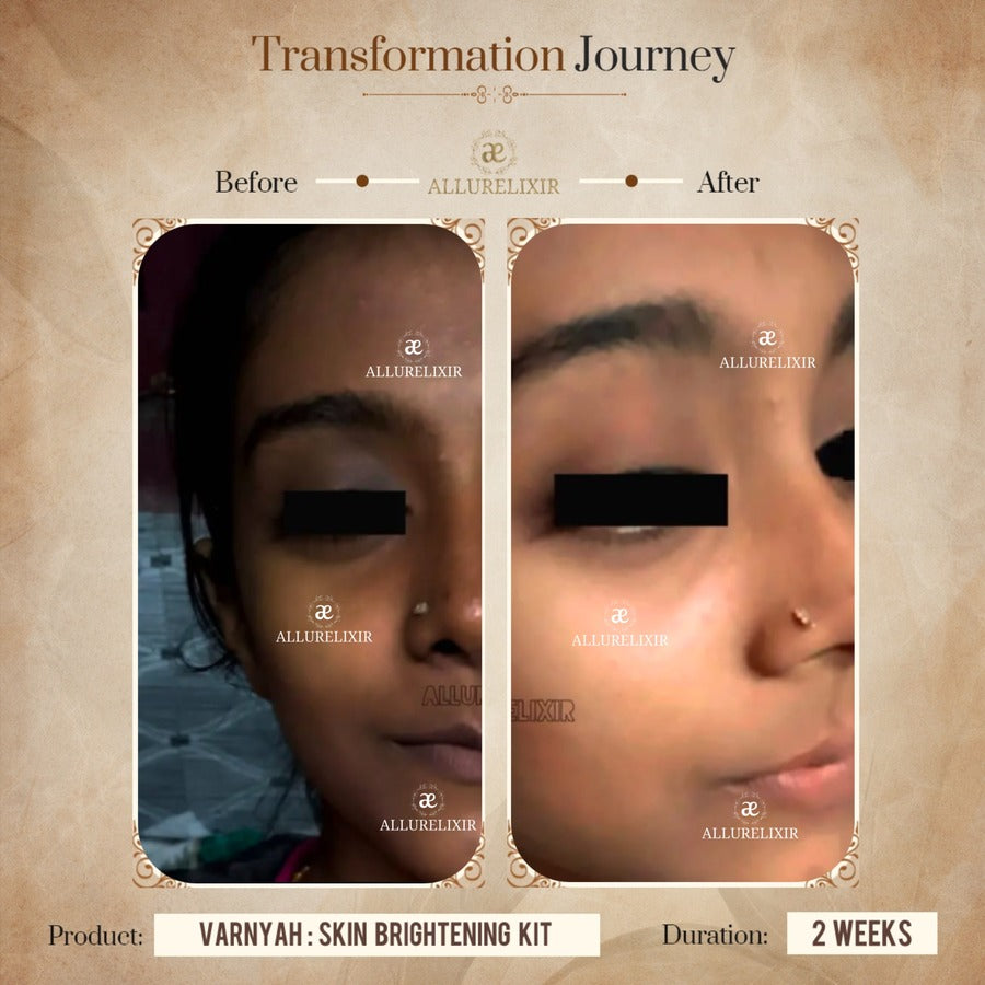 Varnyah : Face Brightening Duo