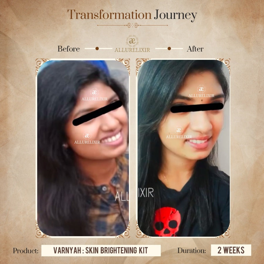 Varnyah : Face Brightening Duo