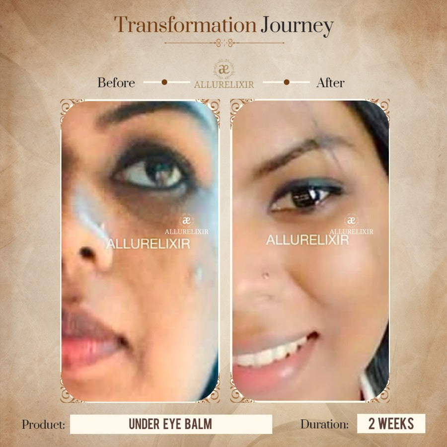 Varnyah : Face Brightening Oil ( Advanced Kumkumadi Oil )