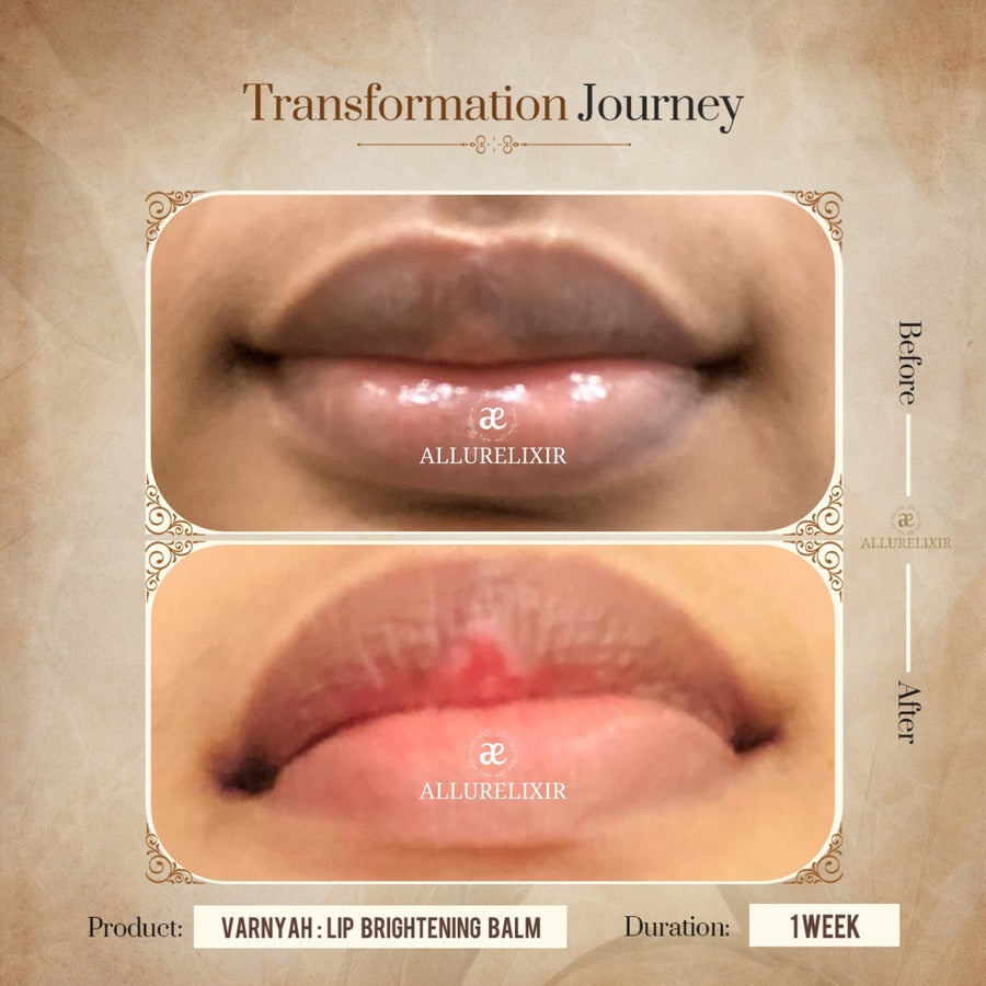 Varnyah: Lip Brightening Balm