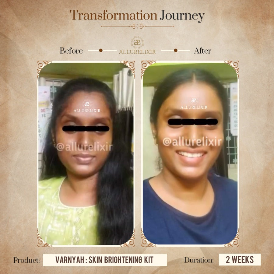 Varnyah : Face Brightening Duo