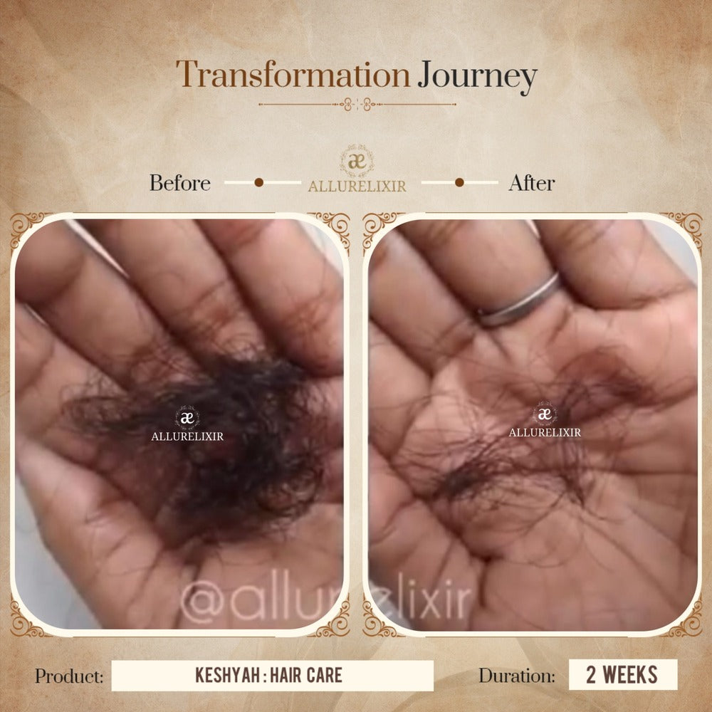 Keshyah: Hair Care Oil (200ml)