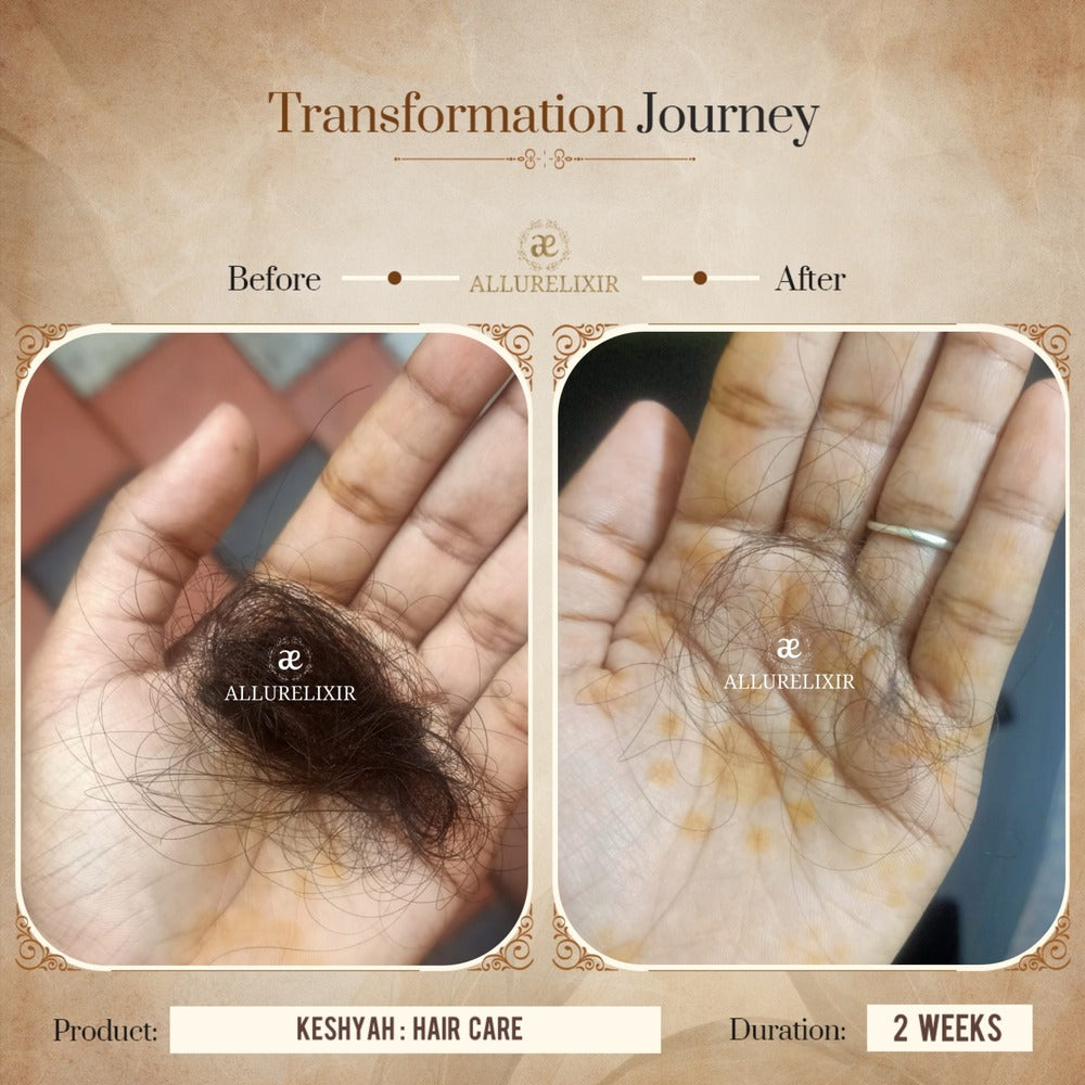 Keshyah: Hair Care Oil (200ml)
