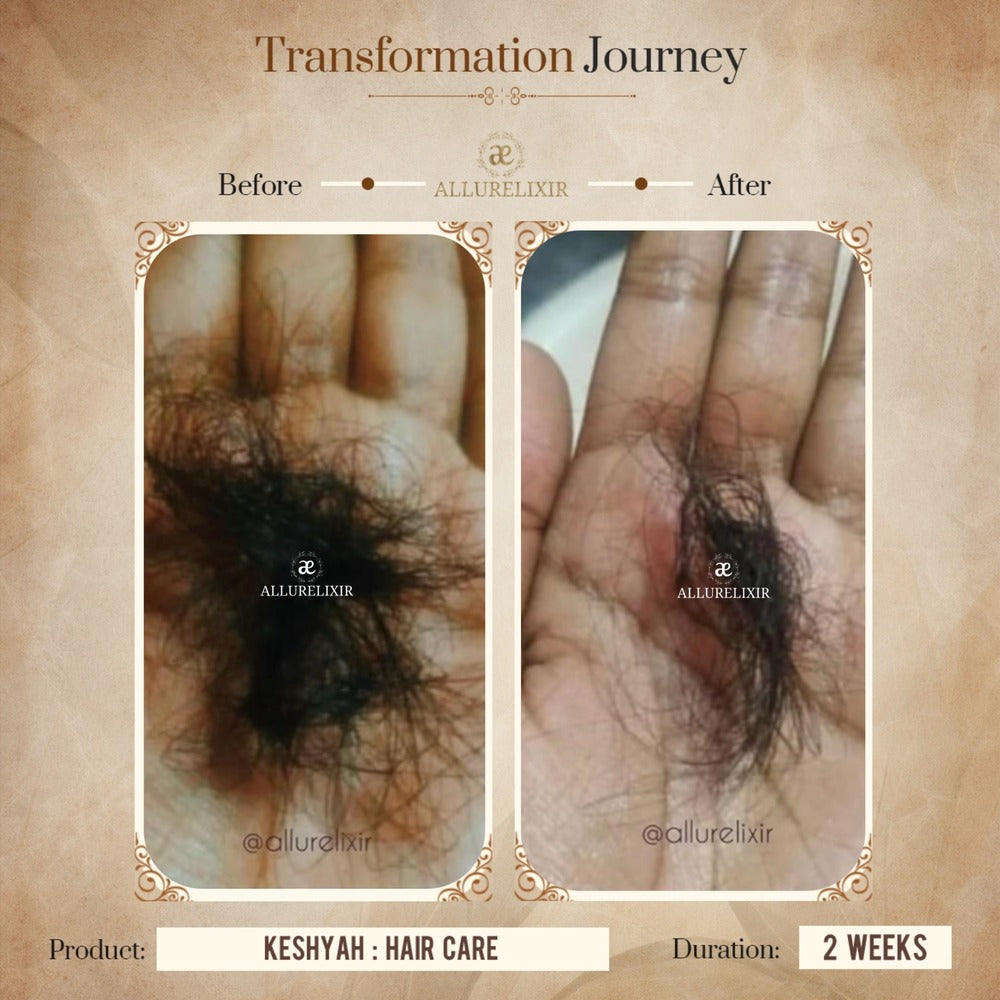 Keshyah: Hair Care Oil (200ml)