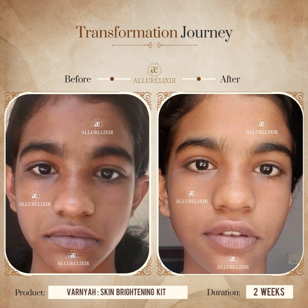 Varnyah : Face Brightening Duo
