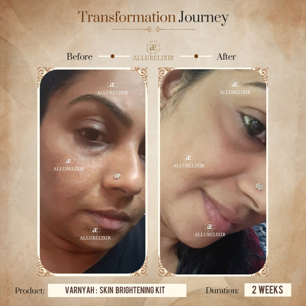 Varnyah : Face Brightening Duo