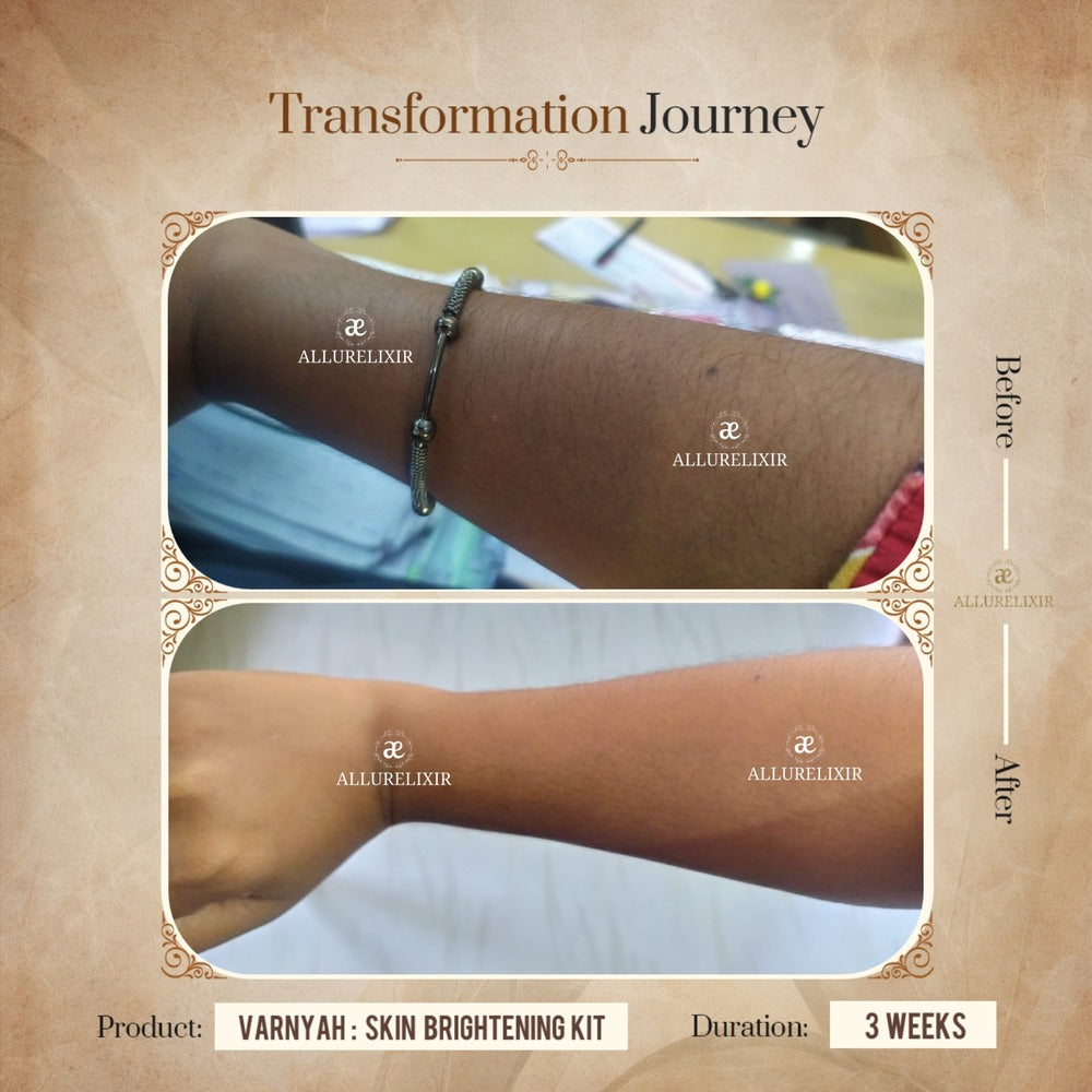 Varnyah Skin Brightening Pack