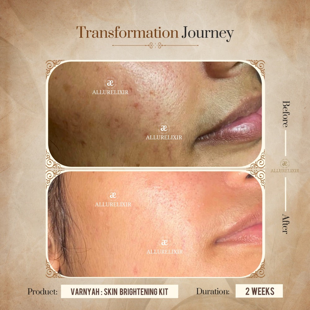 Varnyah : Face Brightening Duo