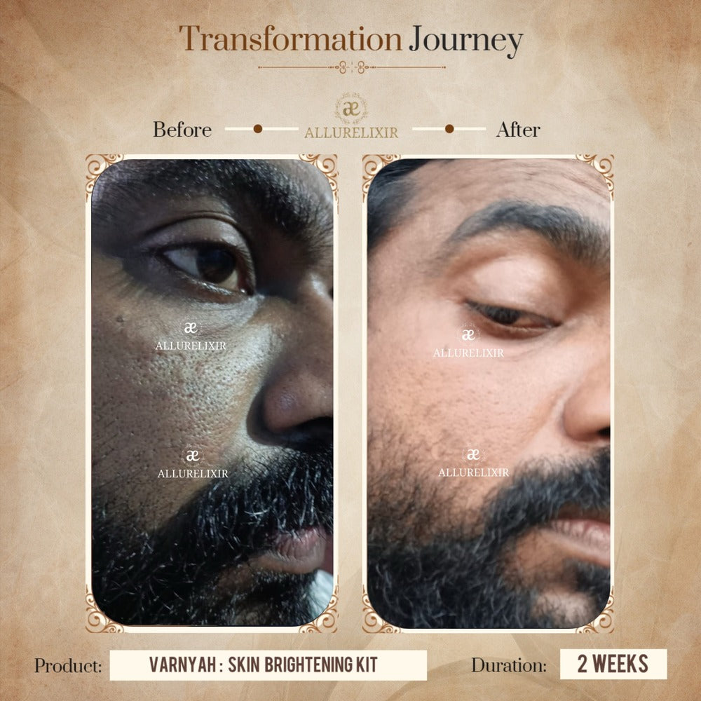 Varnyah : Face Brightening Duo