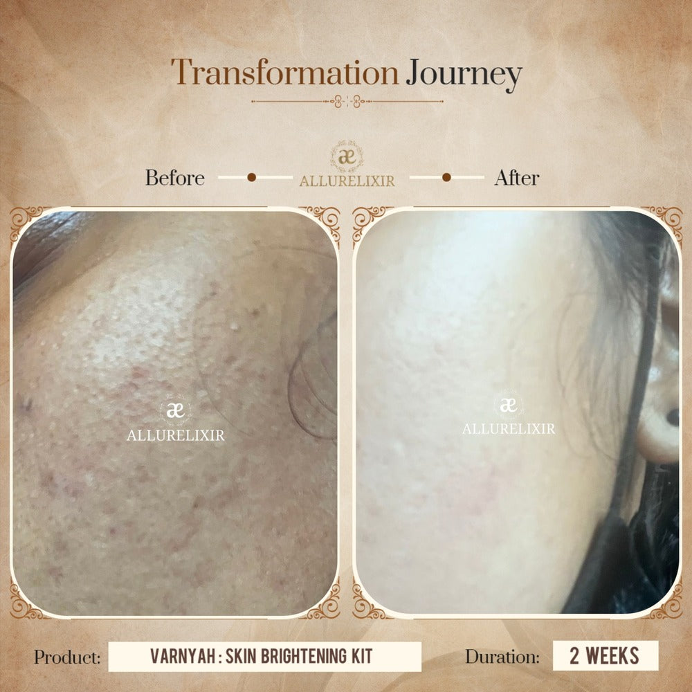 Varnyah Skin Brightening Pack