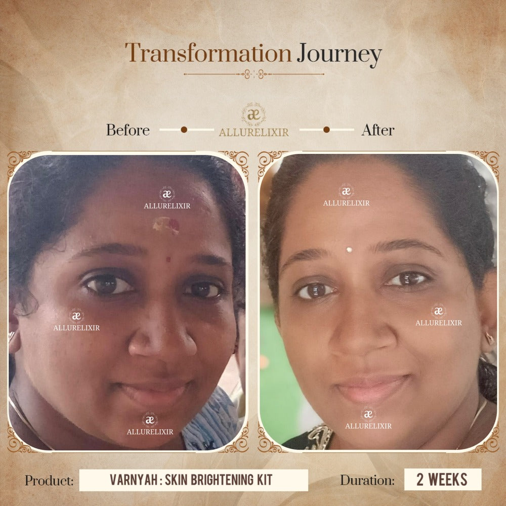 Varnyah Skin Brightening Pack