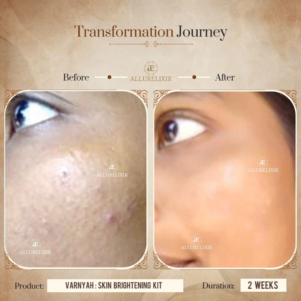 Varnyah : Skin Brightening Kit (Pack + Face Oil + Lip balm + Body Tonic)