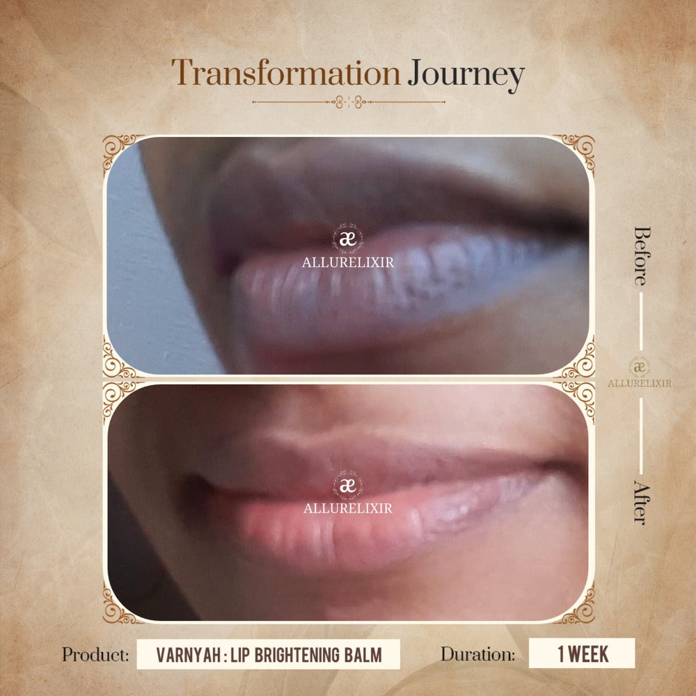 Varnyah: Lip Brightening Balm