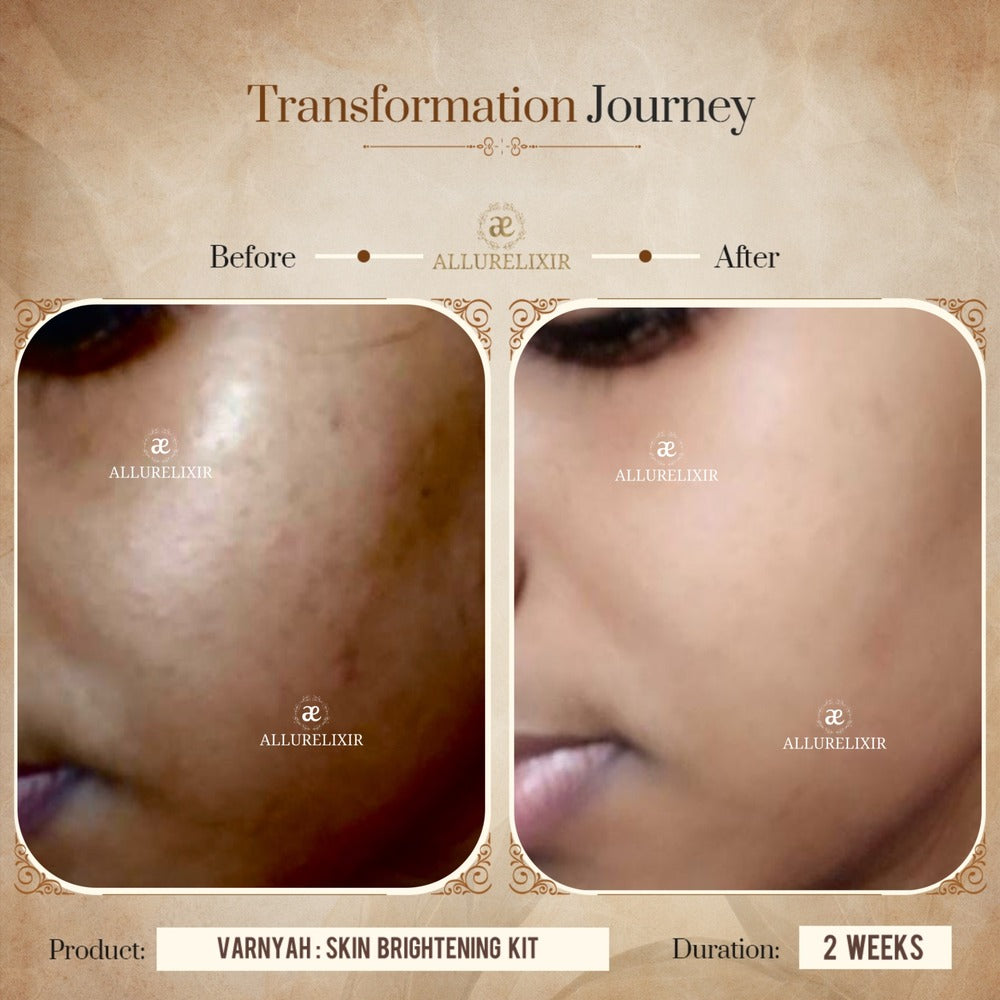 Varnyah : Skin Brightening Kit (Pack + Face Oil + Lip balm + Body Tonic)