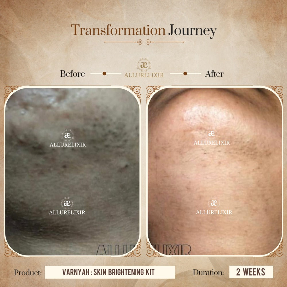 Varnyah Skin Brightening Pack