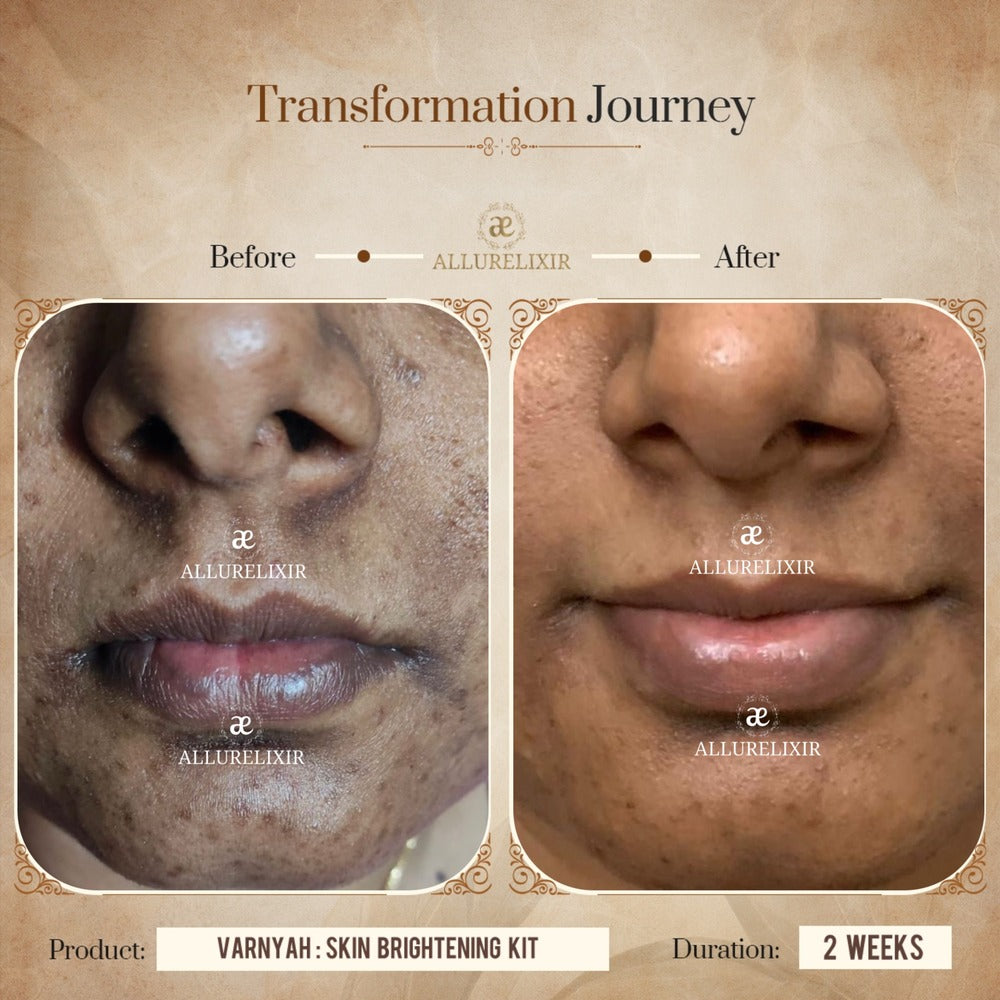 Varnyah : Face Brightening Duo