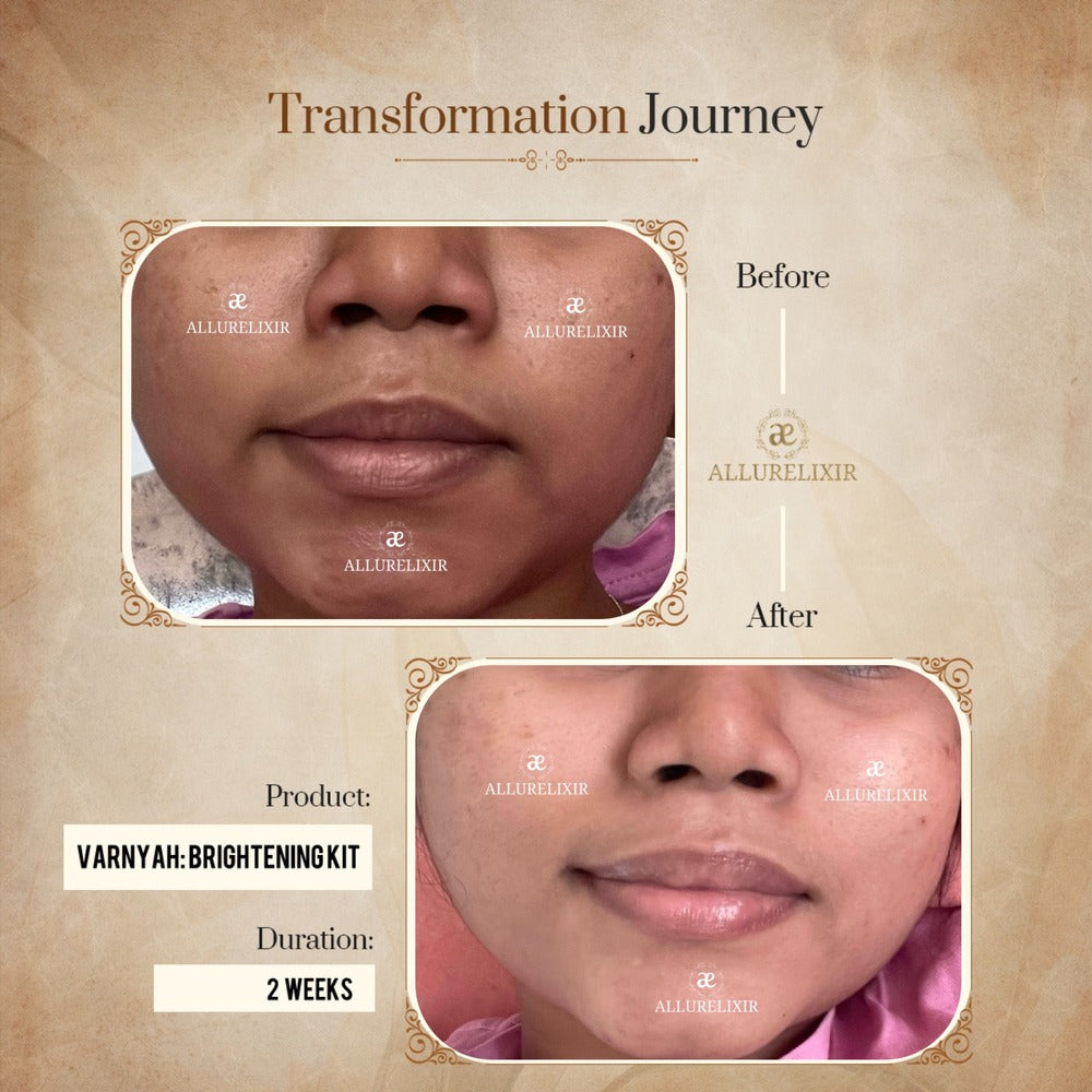 Varnyah : Face Brightening Duo