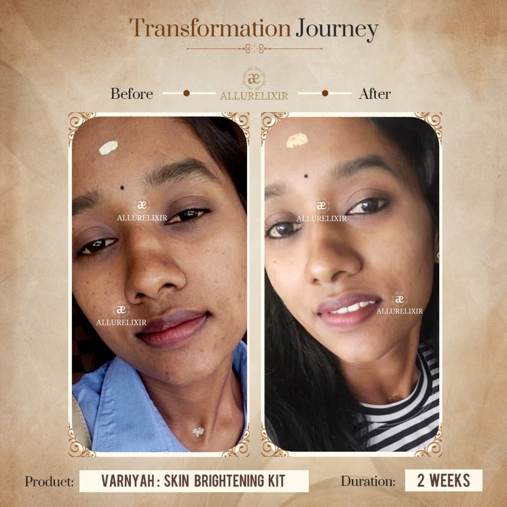 Varnyah : Face Brightening Duo