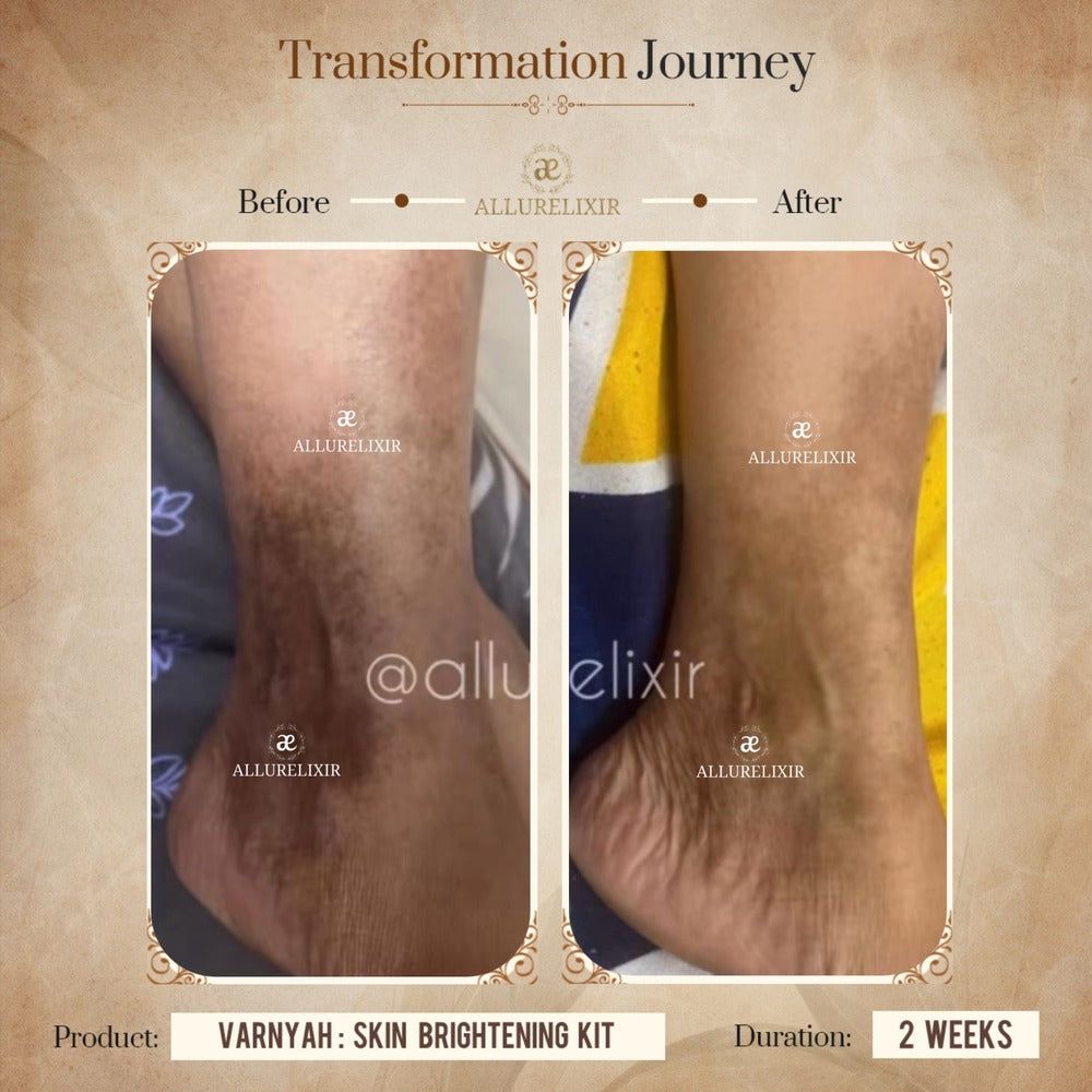 Varnyah Skin Brightening Pack