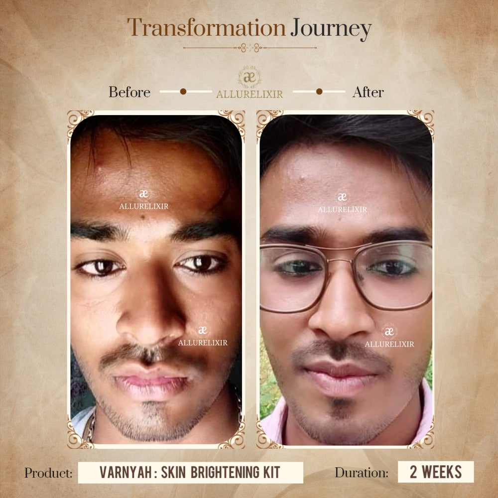 Varnyah Skin Brightening Pack