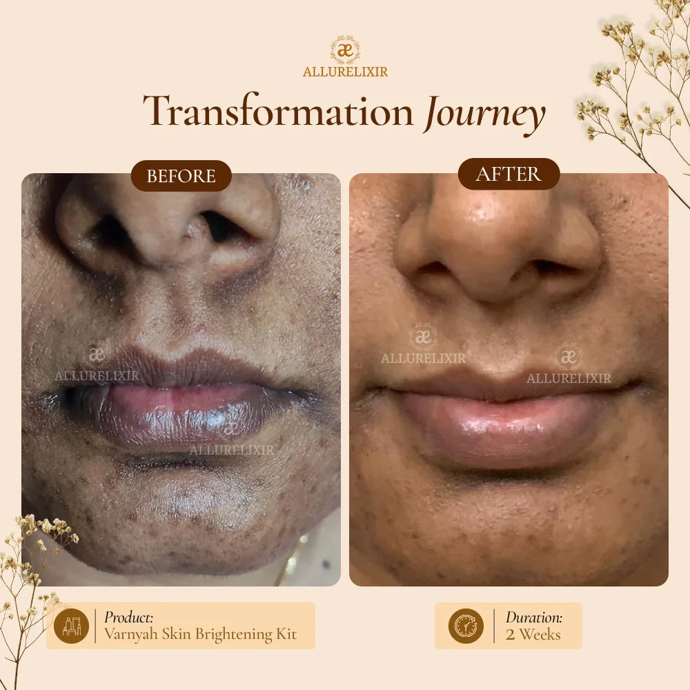 Pimple Skin Brightening Kit ( Tulsnah Pack + Varnyah Pack + Lip balm + Body Lotion )