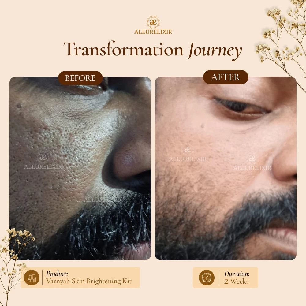 Varnyah : Face Brightening Kit