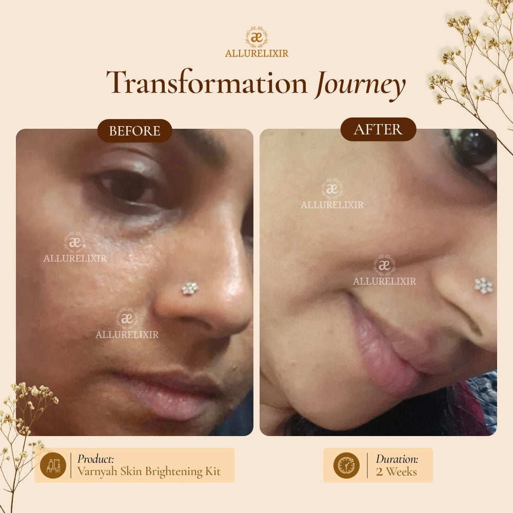 Varnyah : Face Brightening Kit